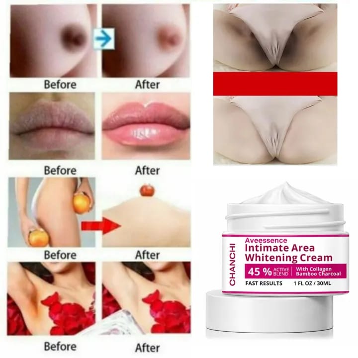 Skin Brightening Cream for Men & Women  Dark Spot Corrector for Even Skin Tone &   Hydrating & Smoothing Formula for Face,  Inner Thighs & Body – Daily Use Moisturizing Cream 30ML |