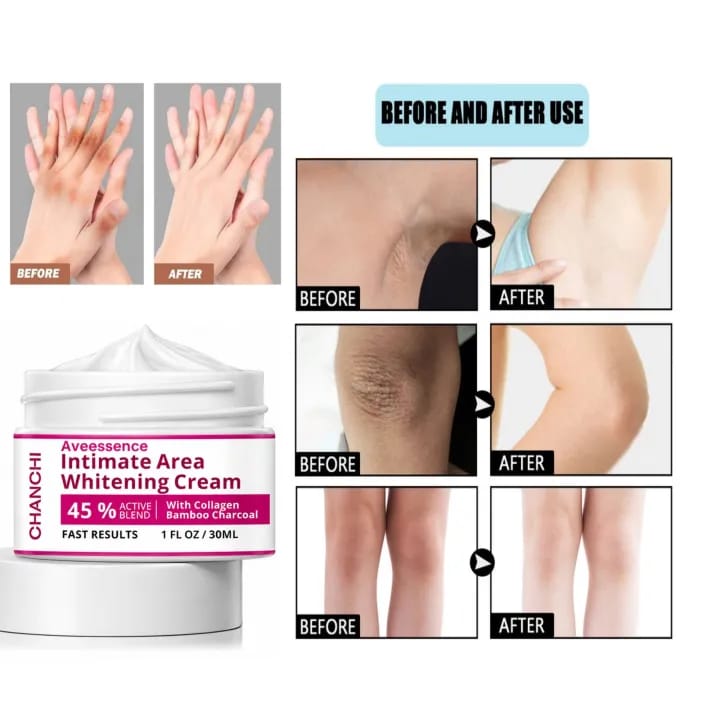 Skin Brightening Cream for Men & Women  Dark Spot Corrector for Even Skin Tone &   Hydrating & Smoothing Formula for Face,  Inner Thighs & Body – Daily Use Moisturizing Cream 30ML |
